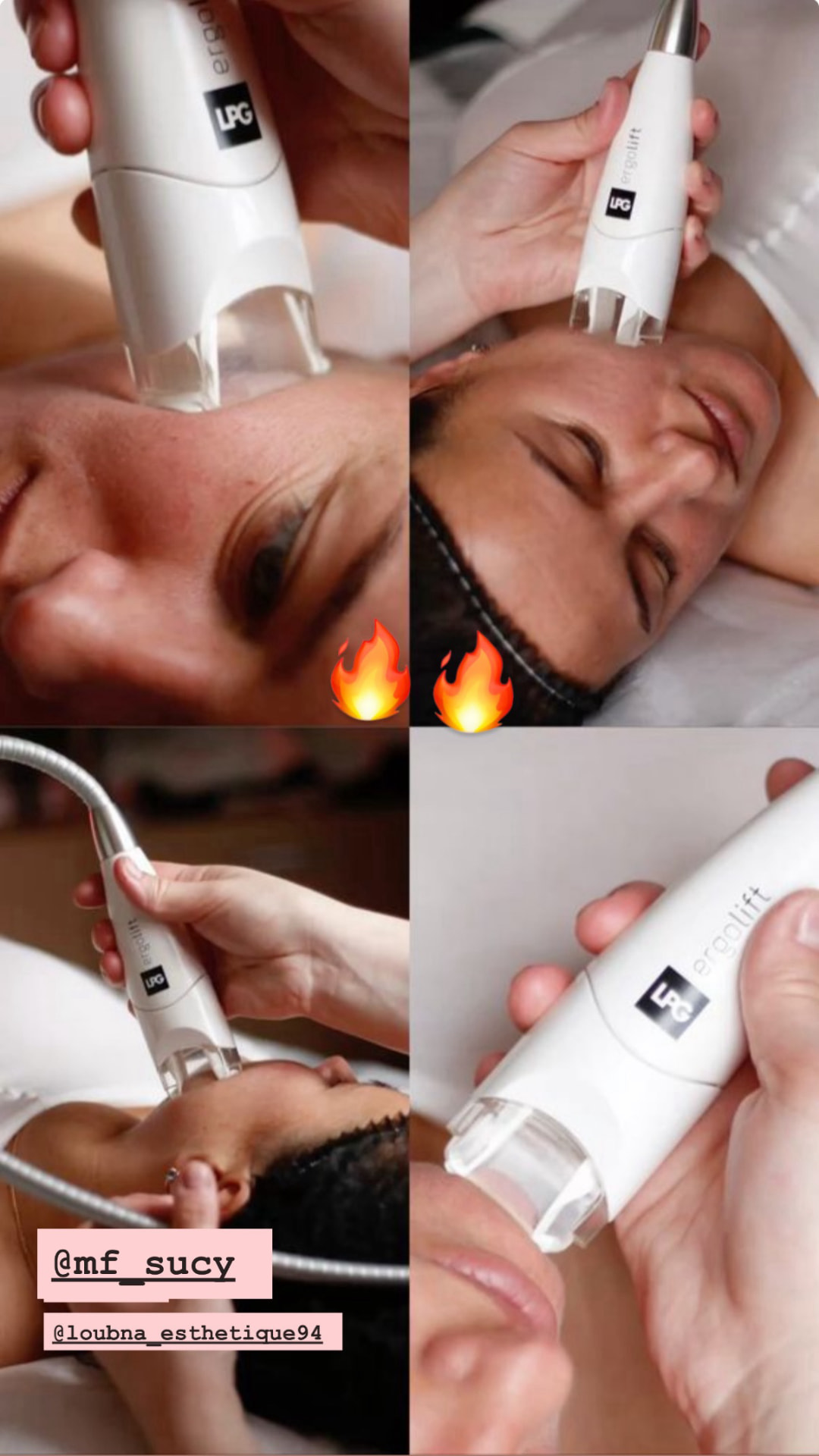 Soin du visage LPG endermolift à l'institut